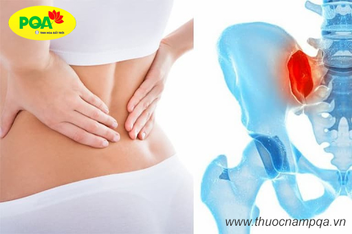 Viêm Khớp Cùng Chậu là gì? Nguyên nhân & cách điều trị hiệu quả