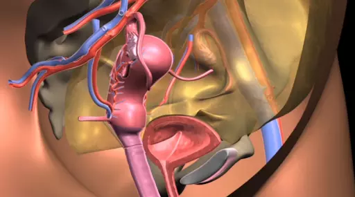 3 Quy tắc "vàng" phục hồi sa tử cung có thể bạn chưa biết