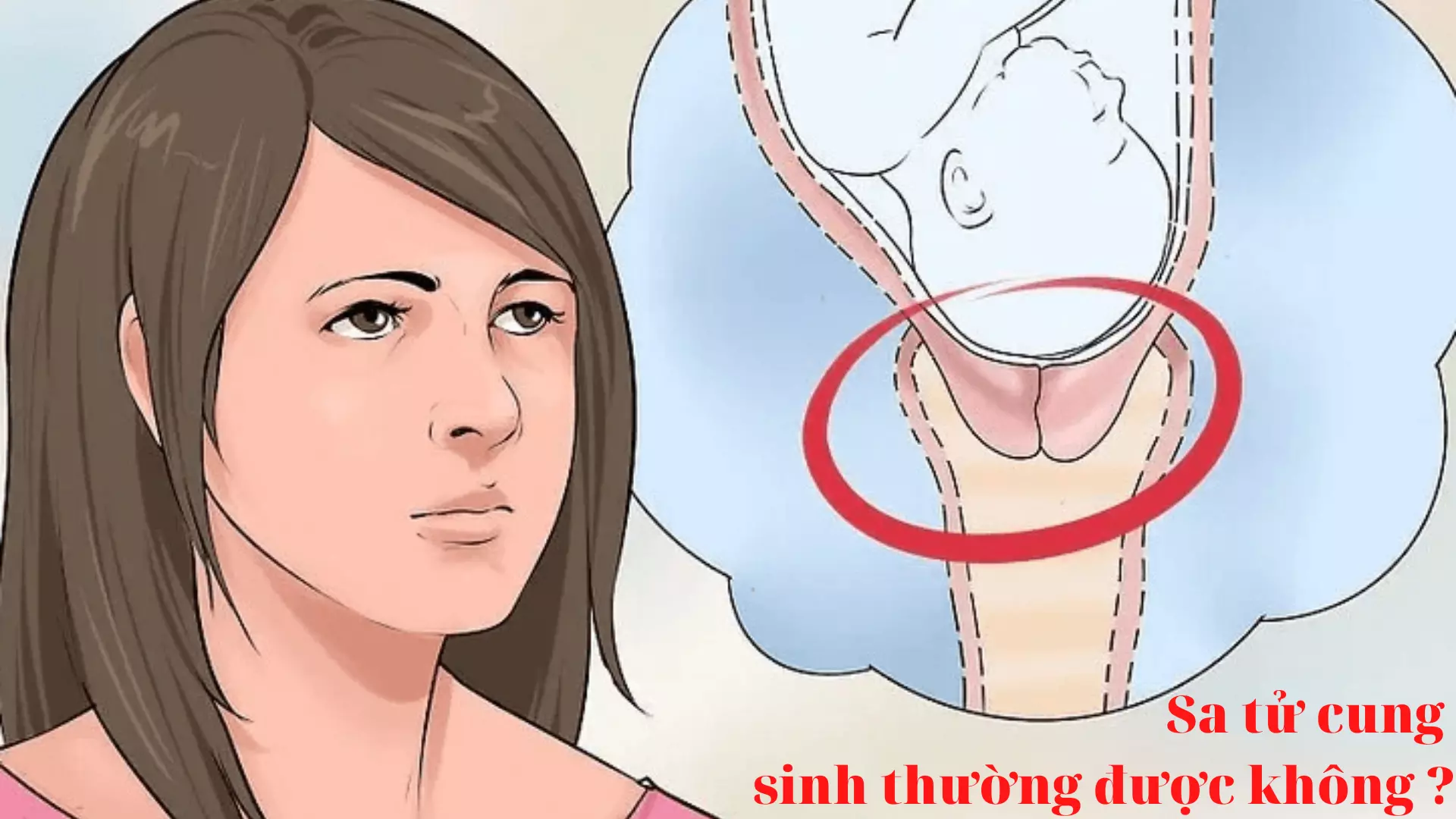 Hỏi - Đáp: Sa tử cung khi mang thai có sinh thường được không?