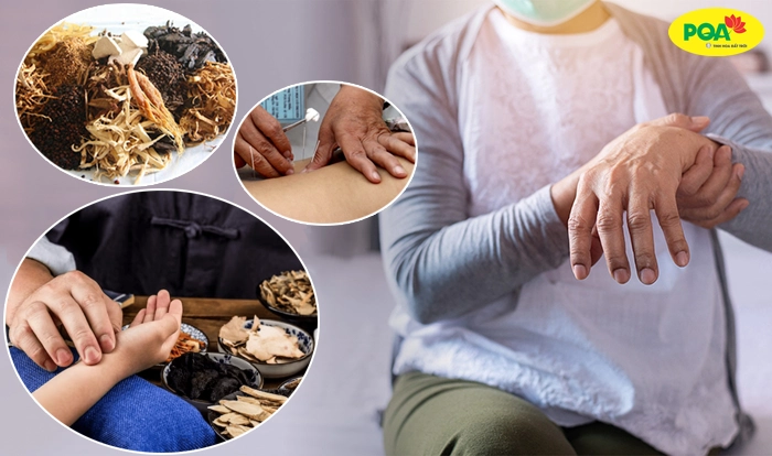 Hiểu rõ bệnh Parkinson theo Y học cổ truyền